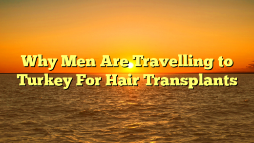 Why Men Are Travelling to Turkey For Hair Transplants